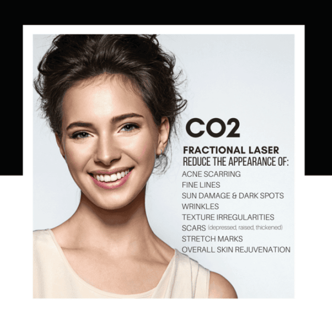 LiteFrax CO2